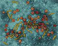 Вирус гепатита поможет избавиться от онкологических заболеваний