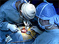Харьковские врачи провели уникальную операцию по пересадке почки