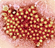 В Воронежской области уже 14 человек заболели гепатитом «А»