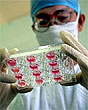 Фальшивый доктор вызвал целую эпидемию гепатита в Китае